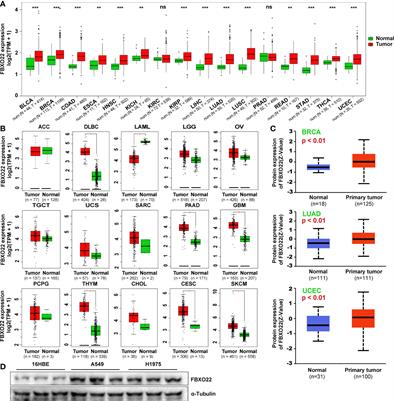 Pan-Cancer Analyses Reveal Oncogenic Role and Prognostic Value of F-Box Only Protein 22